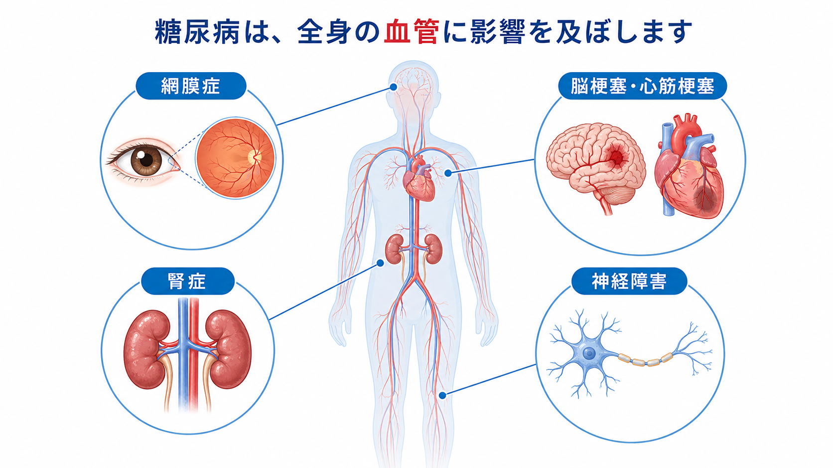 ChatGPT Image 2026年8月5日 17_20_58.png
